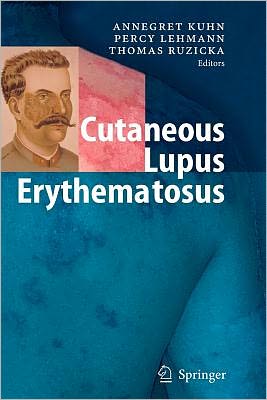 Cutaneous Lupus Erythematosus magazine reviews