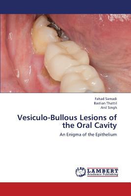 Vesiculo-Bullous Lesions of the Oral Cavity magazine reviews