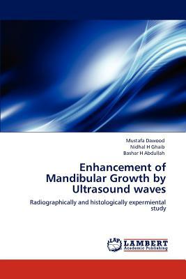 Enhancement of Mandibular Growth by Ultrasound Waves magazine reviews