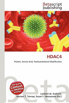 Hdac4 magazine reviews