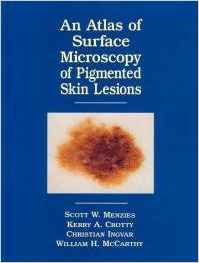 An atlas of surface microscopy of pigmented skin lesions magazine reviews