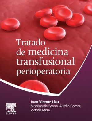 Tratado de medicina transfusional perioperatoria magazine reviews