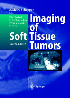 Imaging of Soft Tissue Tumors magazine reviews