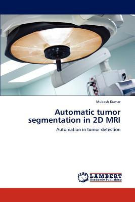 Automatic Tumor Segmentation in 2D MRI magazine reviews