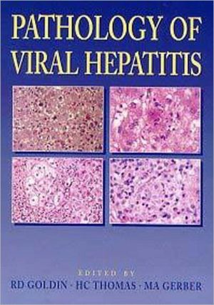 Pathology of Viral Hepatitis magazine reviews