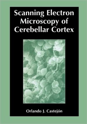 Scanning Electron Microscopy Of Cerebellar Cortex magazine reviews