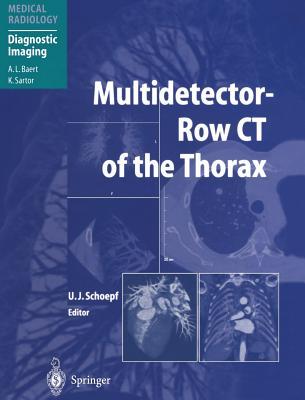 Multidetector-Row CT of the Thorax magazine reviews