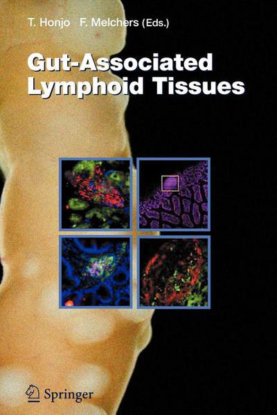 Gut-Associated Lymphoid Tissues magazine reviews