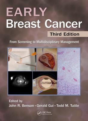 Early Breast Cancer, Third Edition magazine reviews