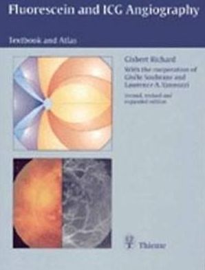 Fluorescein Angiography magazine reviews